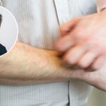 MAL RAUS AUSTHATRINGEN: Aber Wie Den Floh Losserden?