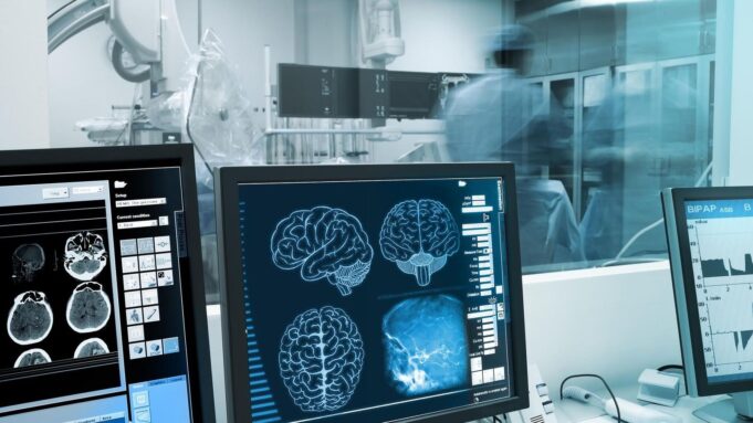 WO Parkinson Entsteht - Forscher Entdecken Halberraschendenursprung

